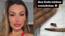 Andressa Urach choca ao mostrar costelas após retirá-las: ‘Que lindas’