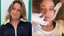 Fernanda Gentil recebe alta após tratar paralisia facial